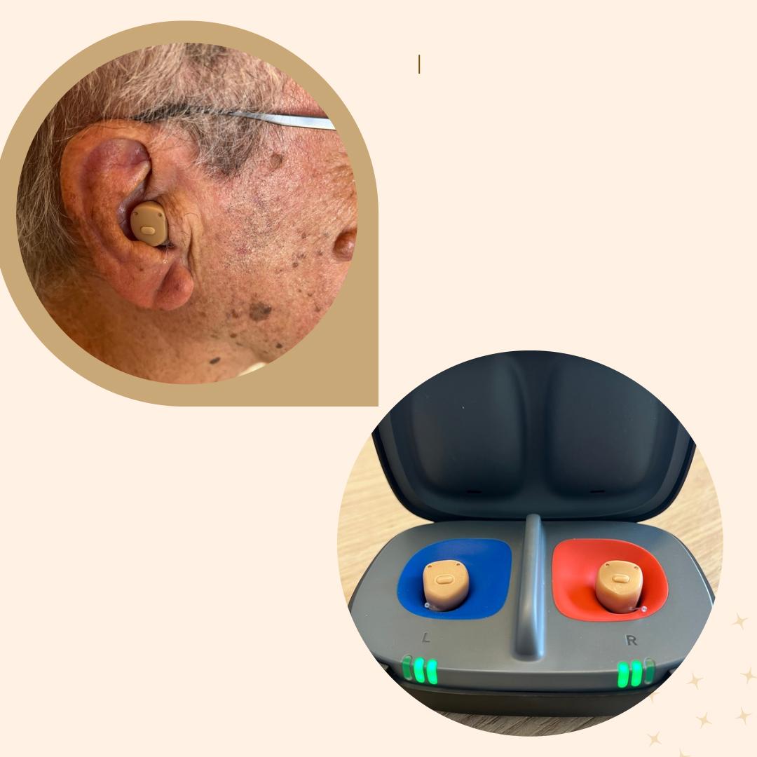 Aparelho auditivo intra-auricular